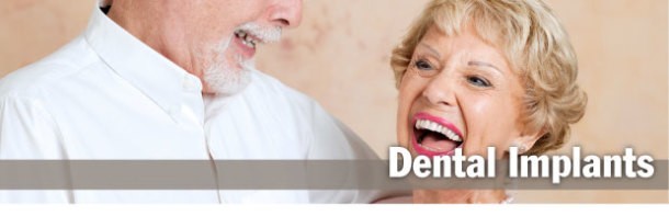 Dental Implants Dental Implants