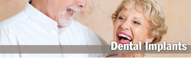 Dental Implants